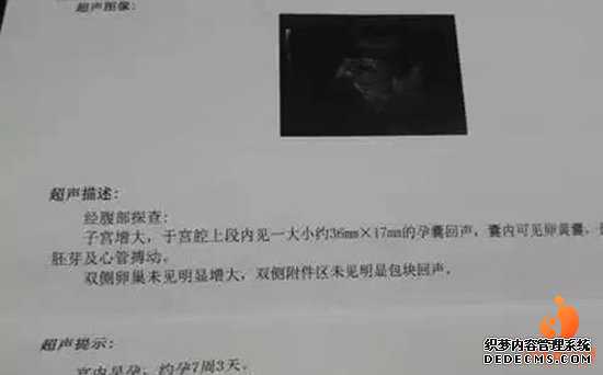 布拖县中国捐卵条件_广州做试管婴儿麻烦吗广州试管需要提供哪些证明